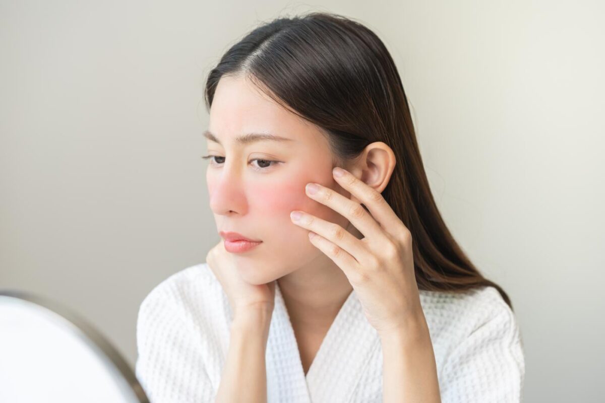 ผู้หญิงหน้าลอกเป็นขุย แสบแดง